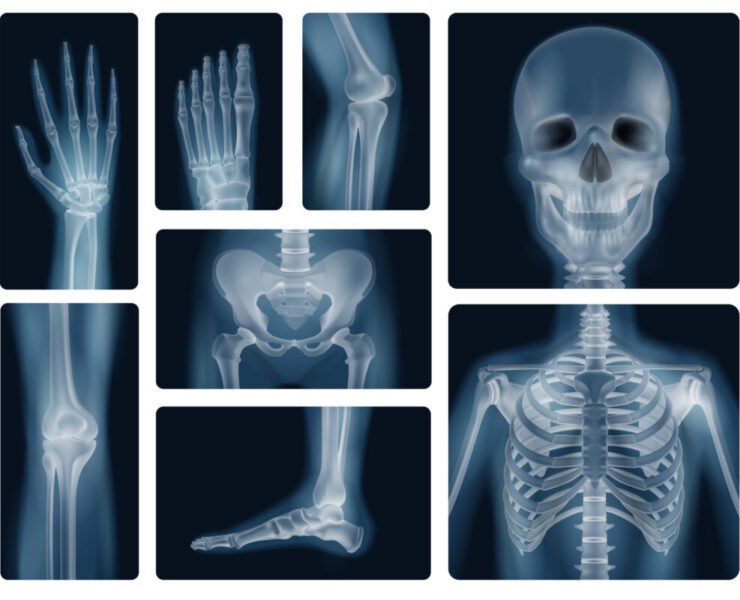 Realistic x-ray shots of human bones of skull pelvis thorax knee and limbs isolated vector illustration